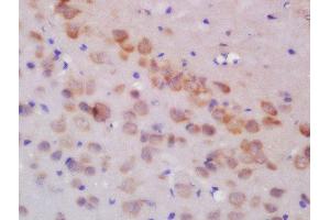 Formalin-fixed and paraffin embedded rat brain labeled with Rabbit Anti-GLUR3 Polyclonal Antibody, Unconjugated  at 1:200 followed by conjugation to the secondary antibody and DAB staining (Glutamate Receptor 3 antibody  (AA 451-550))