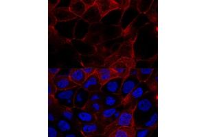 Confocal immunofluorescence analysis of  cells using CD44 antibody (ABIN6127602, ABIN6138193, ABIN6138195 and ABIN7101398) at dilution of 1:200. (CD44 antibody  (AA 148-247))