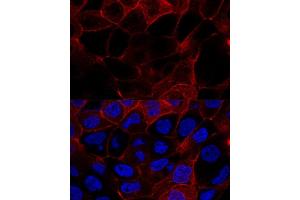 Confocal immunofluorescence analysis of  cells using CD44 antibody (ABIN6127602, ABIN6138193, ABIN6138195 and ABIN7101398) at dilution of 1:200. (CD44 antibody  (AA 148-247))