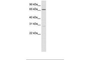 Image no. 1 for anti-Nuclear Factor of Activated T-Cells 5, Tonicity-Responsive (NFAT5) (C-Term) antibody (ABIN6736082)