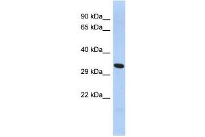 WB Suggested Anti-FOXK2 Antibody Titration:  0. (Forkhead Box K2 antibody  (C-Term))