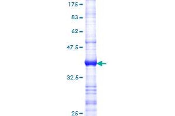 Cyclin D3 Protein (CCND3) (AA 1-100) (GST tag)