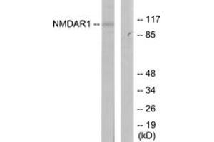Western blot analysis of extracts from Jurkat cells, using NMDAR1 (Ab-897) Antibody. (GRIN1/NMDAR1 antibody  (AA 864-913))