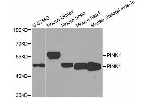 Western blot analysis of extracts of various cell lines, using PINK1 antibody (ABIN5974289) at 1/1000 dilution. (PINK1 antibody)