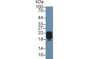 Western blot analysis of Human A549 cell lysate, using Rabbit Anti-Human CAV1 Antibody (2 µg/ml) and HRP-conjugated Goat Anti-Rabbit antibody (abx400043, 0. (Caveolin-1 antibody  (AA 2-104))