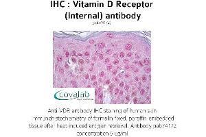 Image no. 1 for anti-Vitamin D Receptor (VDR) (Internal Region) antibody (ABIN1740731) (Vitamin D Receptor antibody  (Internal Region))