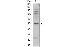 Western Blotting (WB) image for anti-Adrenergic, beta-2-, Receptor, Surface (ADRB2) (AA 302-413) antibody (ABIN5911929)