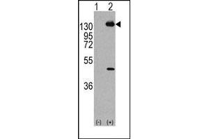 Image no. 1 for anti-Platelet Derived Growth Factor Receptor alpha (PDGFRA) (Tyr768) antibody (ABIN359912)