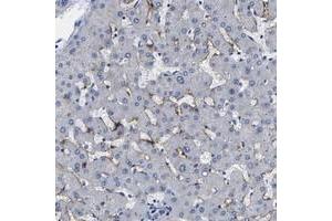 Immunohistochemical staining of human liver with CLEC4G polyclonal antibody  shows distinct positivity in sinusoids. (CLEC4G antibody)