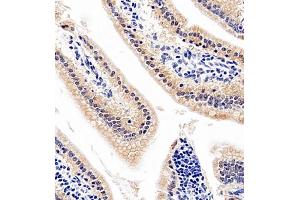 Immunohistochemistry (Paraffin-embedded Sections) (IHC (p)) image for anti-Linker For Activation of T Cells Family, Member 2 (LAT2) antibody (ABIN7074503)