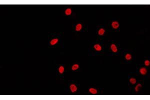 ABIN6269020 staining 293 by IF/ICC. (TBP antibody  (N-Term))