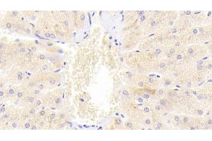 Detection of DR5 in Human Liver Tissue using Polyclonal Antibody to Death receptor 5 (DR5) (TNFRSF10B antibody  (AA 234-435))