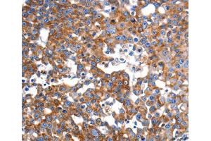 Immunohistochemistry (IHC) image for anti-Inner Membrane Protein, Mitochondrial (IMMT) (AA 120-270) antibody (ABIN3016602) (IMMT antibody  (AA 120-270))