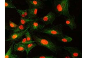 IF analysis of SNRNP40 and Tubulin beta using anti-SNRNP40 antibody (ABIN7601719) and anti-Tubulin beta antibody (ABIN7602744).