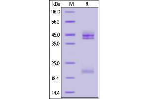 Cynomolgus IL-23A & Mouse IL-12B Heterodimer Protein, His Tag&Tag Free on  under reducing (R) condition.