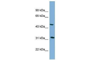 SERPINI2 antibody used at 1 ug/ml to detect target protein. (SERPINI2 antibody)