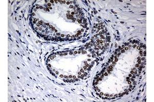 Image no. 1 for anti-Nibrin (NBN) (AA 461-754) antibody (ABIN1491540) (Nibrin antibody  (AA 461-754))