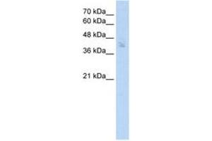 Image no. 1 for anti-Proximal Sequence Element 1 (SPDEF) (AA 31-80) antibody (ABIN204946) (SPDEF/PSE antibody  (AA 31-80))