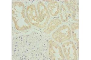 Immunohistochemistry of paraffin-embedded human kidney tissue using ABIN7171763 at dilution of 1:100 (TNS3 antibody  (AA 1-240))