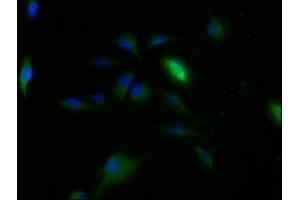 Immunofluorescence staining of U251 cells with ABIN7147821 at 1:150, counter-stained with DAPI. (Clarin 2 antibody  (AA 31-100))