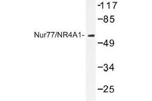 Image no. 1 for anti-Nuclear Receptor Subfamily 4, Group A, Member 1 (NR4A1) antibody (ABIN317895) (NR4A1 antibody)
