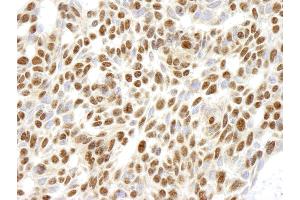 Immunohistochemistry (IHC) image for anti-Ribosomal Protein L26 (RPL26) (C-Term) antibody (ABIN7448782) (RPL26 antibody  (C-Term))