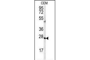 Western blot analysis of anti-AK2 Antibody (N-term) (ABIN392741 and ABIN2842198) in CEM cell line lysates (35 μg/lane). (Adenylate Kinase 2 antibody  (N-Term))