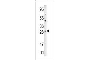 Image no. 1 for anti-Calcium And Integrin Binding Family Member 2 (CIB2) (N-Term) antibody (ABIN360675) (CIB2 antibody  (N-Term))