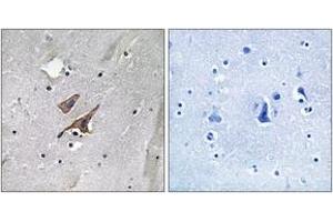 Immunohistochemistry analysis of paraffin-embedded human brain, using TSC2 (Phospho-Tyr1571) Antibody. (Tuberin antibody  (pTyr1571))