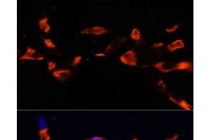 Immunofluorescence analysis of NIH/3T3 cells using MCTS1 Polyclonal Antibody at dilution of 1:100 (40x lens). (MCTS1 antibody)