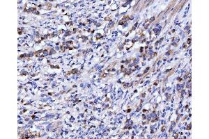 IHC analysis of DHODH using anti-DHODH antibody (ABIN7603139).