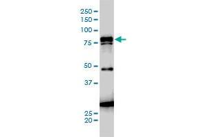 JUP monoclonal antibody (M01A), clone 1D5 Western Blot analysis of JUP expression in A-431 . (JUP antibody  (AA 1-745))