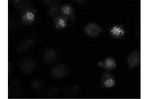 Image no. 1 for anti-Centromere Protein E, 312kDa (CENPE) antibody (ABIN341075) (CENPE antibody)
