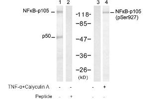 Image no. 1 for anti-Nuclear Factor of kappa Light Polypeptide Gene Enhancer in B-Cells 1 (NFKB1) (pSer927) antibody (ABIN319253) (NFKB1 antibody  (pSer927))