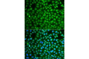 Immunofluorescence analysis of A549 cells using ZNF346 antibody (ABIN5975303). (ZNF346 antibody)