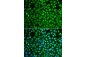 Immunofluorescence analysis of A549 cells using ZNF346 antibody (ABIN5975303). (ZNF346 antibody)