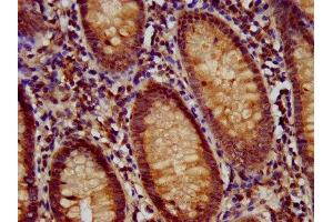 IHC image of ABIN7159682 diluted at 1:700 and staining in paraffin-embedded human appendix tissue performed on a Leica BondTM system. (RFX1 antibody  (AA 36-133))