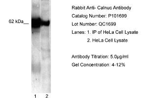 WB Suggested Anti-NUCB1  Antibody Titration: 5. (Nucleobindin 1 antibody  (C-Term))