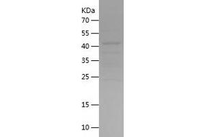 Western Blotting (WB) image for Pituitary Tumor-Transforming 1 (PTTG1) (AA 1-202) protein (His-IF2DI Tag) (ABIN7283665) (PTTG1 Protein (AA 1-202) (His-IF2DI Tag))