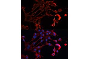 Immunofluorescence analysis of NIH/3T3 cells using  antibody (ABIN7265433) at dilution of 1:100. (ADAM11 antibody  (AA 290-430))