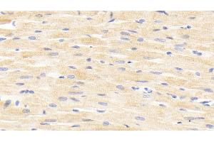 Detection of ANGPTL4 in Rat Cardiac Muscle Tissue using Polyclonal Antibody to Angiopoietin Like Protein 4 (ANGPTL4) (ANGPTL4 antibody  (AA 182-394))