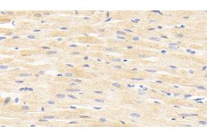 Detection of ANGPTL4 in Rat Cardiac Muscle Tissue using Polyclonal Antibody to Angiopoietin Like Protein 4 (ANGPTL4) (ANGPTL4 antibody  (AA 182-394))
