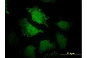 Image no. 5 for anti-EH-Domain Containing 3 (EHD3) (AA 357-407) antibody (ABIN599233) (EHD3 antibody  (AA 357-407))