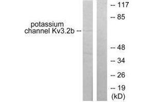 Western blot analysis of extracts from HepG2 cells, using Potassium Channel Kv3.