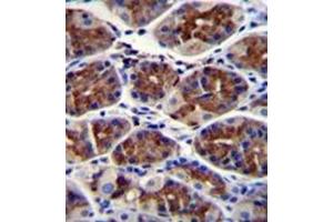 Formalin fixed and paraffin embedded human stomach tissue reacted with ABHD9 Antibody (C-term) followed by peroxidase conjugation of the secondary antibody and DAB staining. (ABHD9 antibody  (C-Term))