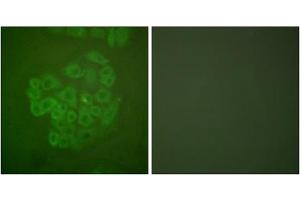 Immunofluorescence analysis of A549 cells, using GR (epitope around residue 211) antibody (ABIN5976159). (GR (Internal Region), (pSer211) antibody)