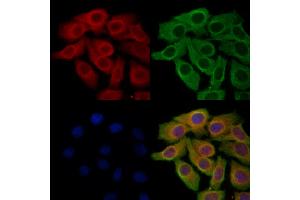ABIN6265094 and ABIN6278291 staining Hela cells by IF/ICC. (SIRT5 antibody  (Internal Region))