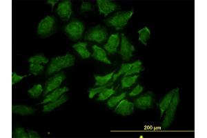 Immunofluorescence of monoclonal antibody to RAB9A on HeLa cell. (RAB9A antibody  (AA 17-115))