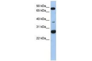 Image no. 1 for anti-Chromosome 1 Open Reading Frame 110 (C1ORF110) (AA 35-84) antibody (ABIN6743881) (C1ORF110 antibody  (AA 35-84))