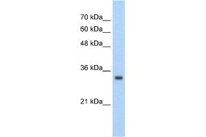 WB Suggested Anti-ZNF227 Antibody Titration:  2. (ZNF227 antibody  (Middle Region))